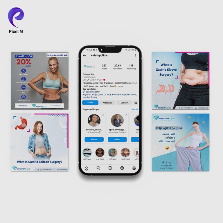 social-media-management-pixelm-2