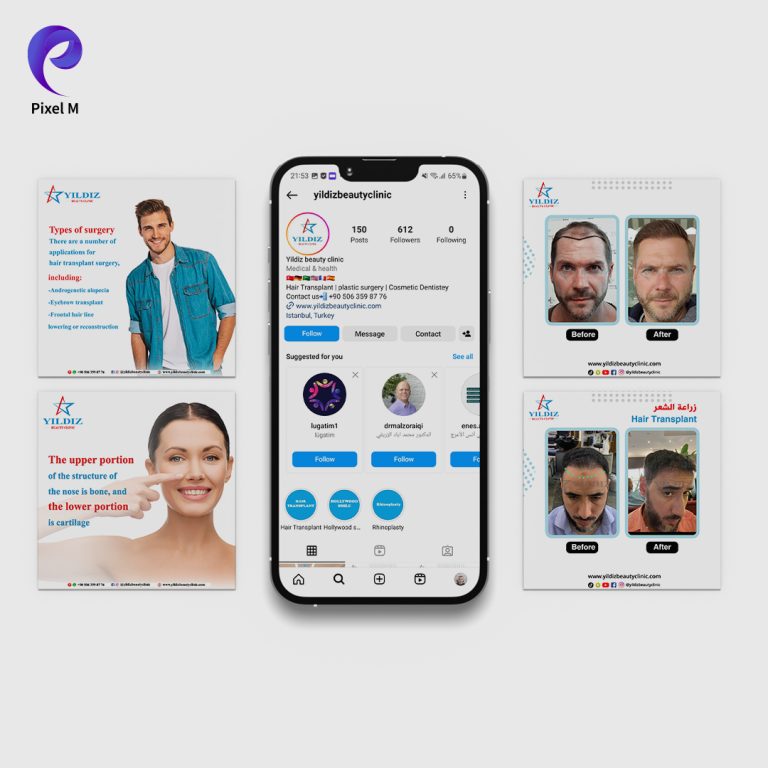تصاميم بوستات مخصصة لحملة عروض موسمية ضمن خدمة إدارة الحسابات
